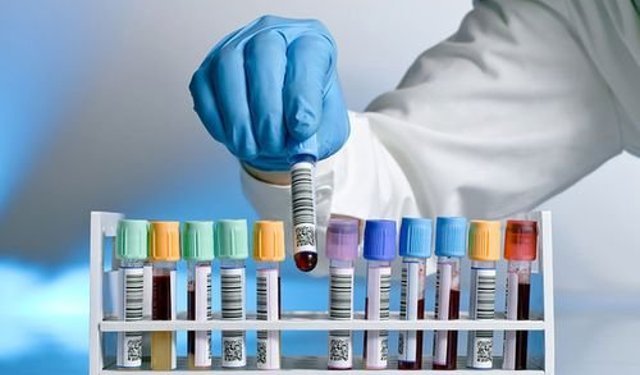 'Memura uyuşturucu testi zorunlu hale gelmeli'